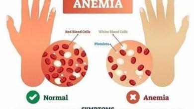 Photo of एनीमिया की बीमारी, जान पर पड़ सकती है भारी