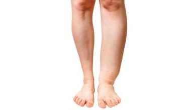 Photo of जिले में फाइलेरिया उन्मूलन को 21 दिसंबर से चलेगा आईडीए अभियान