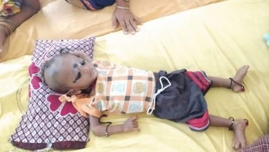 Photo of पोषण एवं पुनर्वास केंद्र में अति कुपोषित बच्चों को मिलती है बेहतर स्वास्थ्य सेवाएं 