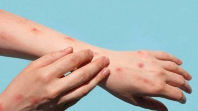 Photo of मंकी पॉक्स से बचाव के लिए स्वास्थ्य विभाग अलर्ट मोड में, कर्मियों को स्टैंडर्ड ऑपरेटिंग प्रोटोकॉल के पालन का निर्देश