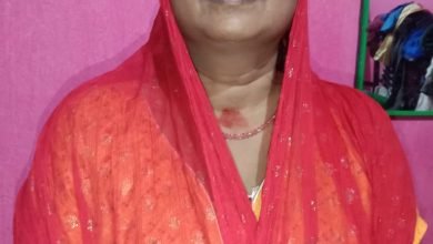 Photo of टीबी के लक्षण पता चलने पर निजी के बजाय जाएं सरकारी अस्पताल