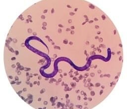 Photo of बिहार के 14 जिलों में पहली बार होगा प्रखंड स्तरीय नाईट ब्लड सर्वे