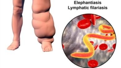 Photo of नाइट ब्लड सर्वे रिपोर्ट के अनुसार  जिले भर में अभी हैं कुल 6048 फाइलेरिया के मरीज