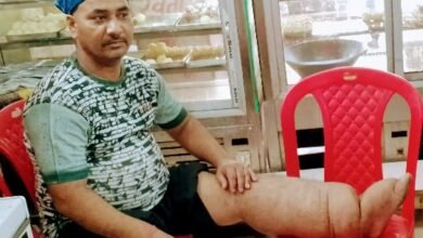 Photo of संकट मोचन पेशेंट प्लेटफार्म के तहत फाइलेरिया बीमारी के प्रति लोगों को कर रहें हैं जागरूक 